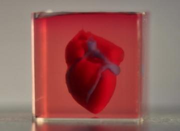 In 3D thành công quả tim dùng chính tế bào của bệnh nhân